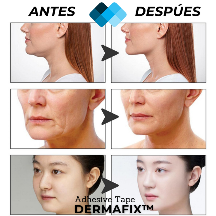 (PACK 120 Unidades) Tiras de Lifting facial efecto Natural "Buena Cara"