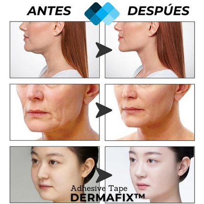 (PACK 120 Unidades) Tiras de Lifting facial efecto Natural "Buena Cara"